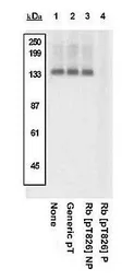 Anti-Rb (phospho Thr826) antibody used in Western Blot (WB). GTX24779