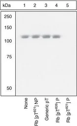 Anti-Rb (phospho Thr821) antibody used in Western Blot (WB). GTX24787