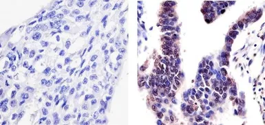 Anti-PYK2 (phospho Tyr402) antibody used in IHC (Paraffin sections) (IHC-P). GTX24800
