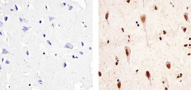 Anti-PYK2 (phospho Tyr402) antibody used in IHC (Paraffin sections) (IHC-P). GTX24800