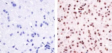 Anti-PYK2 (phospho Tyr402) antibody used in IHC (Paraffin sections) (IHC-P). GTX24800