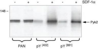 Anti-PYK2 (phospho Tyr402) antibody used in Western Blot (WB). GTX24800
