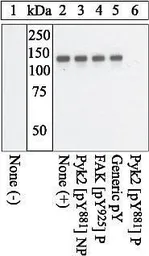 Anti-PYK2 (phospho Tyr881) antibody used in Western Blot (WB). GTX24801