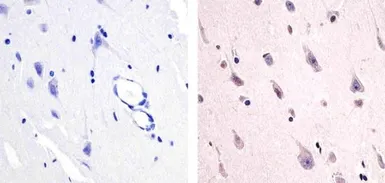 Anti-PYK2 (phospho Tyr579) antibody used in IHC (Paraffin sections) (IHC-P). GTX24805