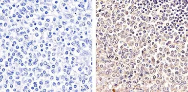 Anti-PYK2 (phospho Tyr579/Tyr580) antibody used in IHC (Paraffin sections) (IHC-P). GTX24807