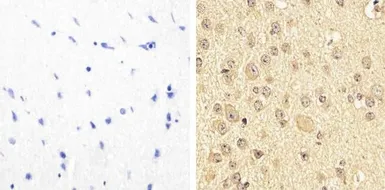 Anti-PYK2 (phospho Tyr579/Tyr580) antibody used in IHC (Paraffin sections) (IHC-P). GTX24807