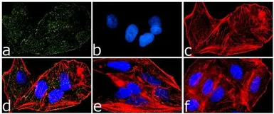 Anti-PYK2 (phospho Tyr579/Tyr580) antibody used in Immunocytochemistry/ Immunofluorescence (ICC/IF). GTX24807