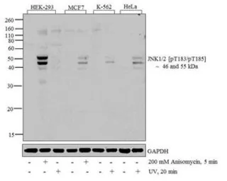 Anti-JNK (phospho Thr183/Tyr185) antibody used in Western Blot (WB). GTX24821