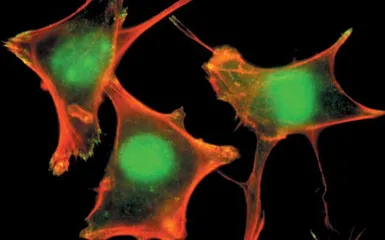 Anti-PLCG1 (phospho Tyr783) antibody used in Immunocytochemistry/ Immunofluorescence (ICC/IF). GTX24828