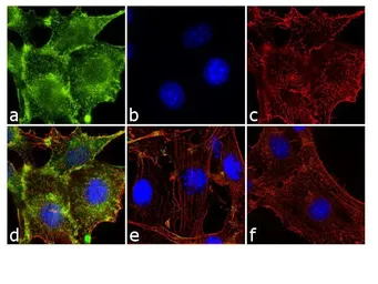 Anti-Paxillin (phospho Tyr31) antibody used in Immunocytochemistry/ Immunofluorescence (ICC/IF). GTX24832
