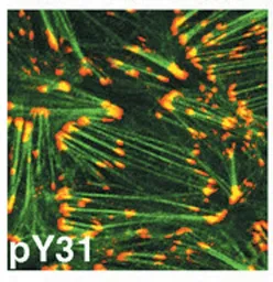 Anti-Paxillin (phospho Tyr31) antibody used in Immunocytochemistry/ Immunofluorescence (ICC/IF). GTX24832