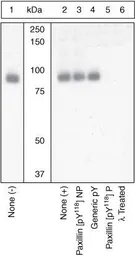 Anti-Paxillin (phospho Tyr118) antibody used in Western Blot (WB). GTX24833