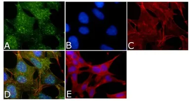 Anti-Tau (phospho Thr212) antibody used in Immunocytochemistry/ Immunofluorescence (ICC/IF). GTX24842