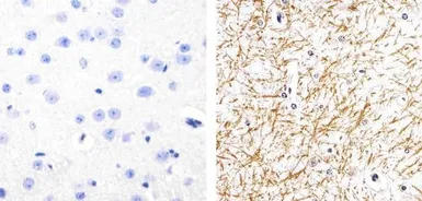 Anti-Tau (phospho Ser262) antibody used in IHC (Paraffin sections) (IHC-P). GTX24856
