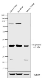 Anti-Tau (phospho Ser262) antibody used in Western Blot (WB). GTX24856