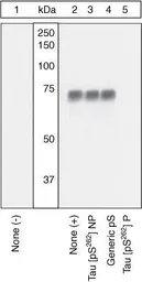Anti-Tau (phospho Ser262) antibody used in Western Blot (WB). GTX24856