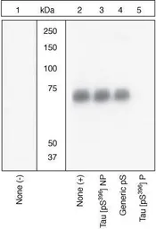 Anti-Tau (phospho Ser396) antibody used in Western Blot (WB). GTX24858