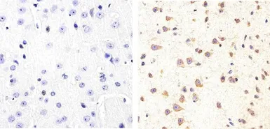 Anti-Tau (phospho Ser409) antibody used in IHC (Paraffin sections) (IHC-P). GTX24861