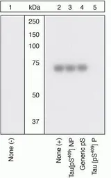 Anti-Tau (phospho Ser409) antibody used in Western Blot (WB). GTX24861