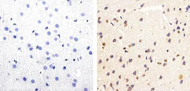 Anti-Tau (phospho Ser199/Ser202) antibody used in IHC (Paraffin sections) (IHC-P). GTX24864