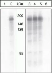 Anti-IRS1 (phospho Ser312) antibody used in Western Blot (WB). GTX24865