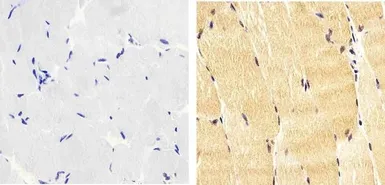 Anti-IRS1 (phospho Tyr612) antibody used in IHC (Paraffin sections) (IHC-P). GTX24868