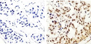 Anti-IRS1 (phospho Tyr896) antibody used in IHC (Paraffin sections) (IHC-P). GTX24873