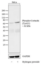 Anti-Cortactin (phospho Tyr421) antibody used in Western Blot (WB). GTX24904