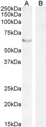 Anti-FOXC2 antibody, C-term used in Western Blot (WB). GTX25060