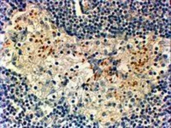 Anti-FOXC2 antibody, C-term used in IHC (Paraffin sections) (IHC-P). GTX25060