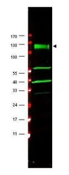 Anti-FANCA antibody used in Western Blot (WB). GTX25063