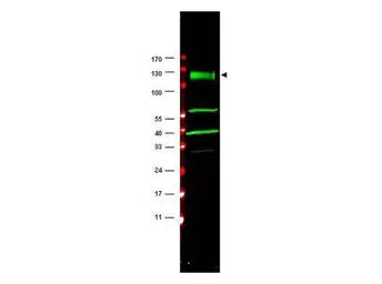 Anti-FANCA antibody used in Western Blot (WB). GTX25063