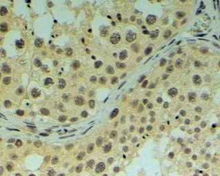 Anti-REV1 antibody, C-term used in IHC (Paraffin sections) (IHC-P). GTX25088