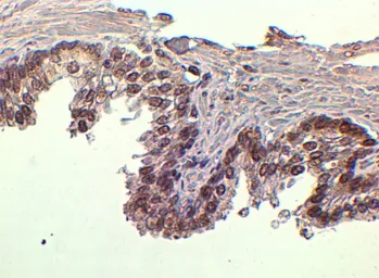 Anti-FOXA1 antibody, C-term used in IHC (Paraffin sections) (IHC-P). GTX25089