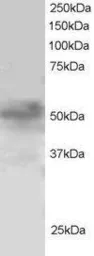 Anti-FOXQ1 antibody, N-term used in Western Blot (WB). GTX25098