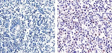 Anti-GATA4 (phospho Ser105) antibody used in IHC (Paraffin sections) (IHC-P). GTX25245