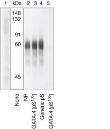 Anti-GATA4 (phospho Ser105) antibody used in Western Blot (WB). GTX25245