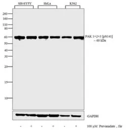 Anti-PAK (phospho Ser141) antibody used in Western Blot (WB). GTX25247