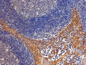 Anti-Importin 8 antibody, C-term used in IHC (Paraffin sections) (IHC-P). GTX25263