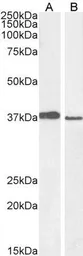 Anti-MEL18 antibody, C-term used in Western Blot (WB). GTX25267