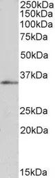 Anti-FOXB1 antibody, C-term used in Western Blot (WB). GTX25274
