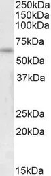 Anti-FOXK2 (isoform 1) antibody, C-term used in Western Blot (WB). GTX25298