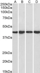 Anti-NIPP1 antibody, C-term used in Western Blot (WB). GTX25300