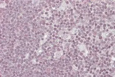 Anti-NIPP1 antibody, C-term used in IHC (Paraffin sections) (IHC-P). GTX25300