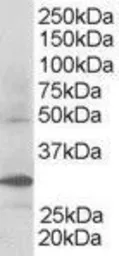 Anti-FBXW2 antibody, C-term used in Western Blot (WB). GTX25309