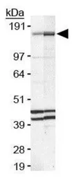 Anti-FANCD2 antibody [FI-17] used in Western Blot (WB). GTX25360