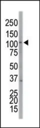 Anti-EphA7 antibody used in Western Blot (WB). GTX25411