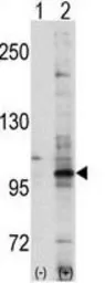Anti-EphA7 antibody used in Western Blot (WB). GTX25411