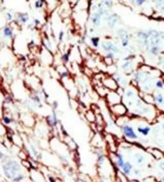 Anti-EphA7 antibody used in IHC (Paraffin sections) (IHC-P). GTX25411