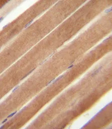 Anti-EphB2 antibody used in IHC (Paraffin sections) (IHC-P). GTX25418
